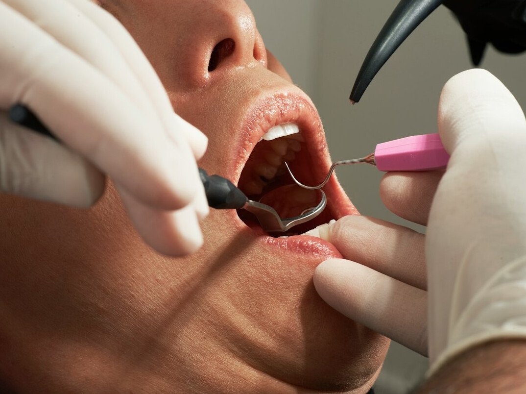 dental checkup